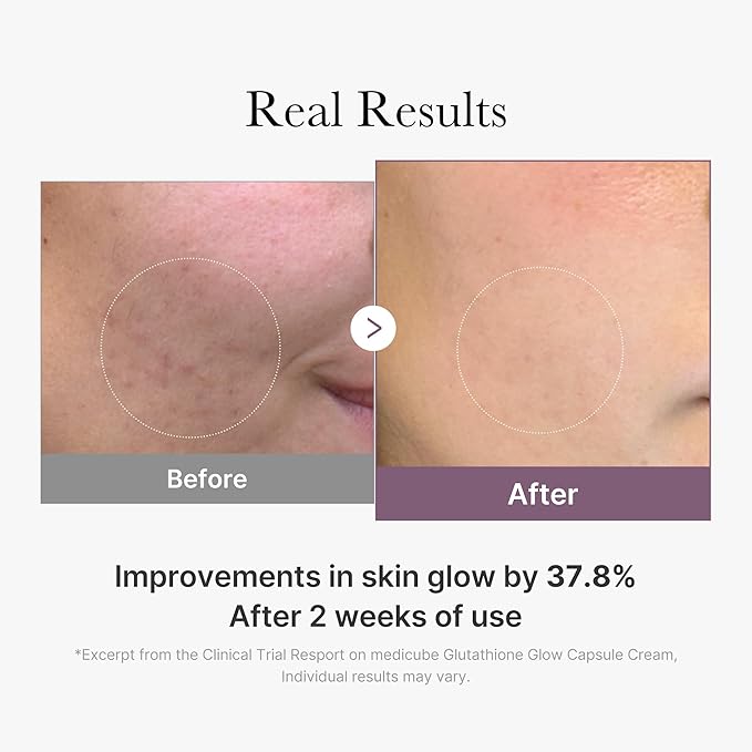 medicube AGE-R Glutathione Glow Capsule Facial Cream - Instant Lifting Moisturizer - Collagen Peptide For Hydrating Glow - Improve Blemishes, Uneven Skin Tone - Korean Skin Care 1.69 fl.oz
