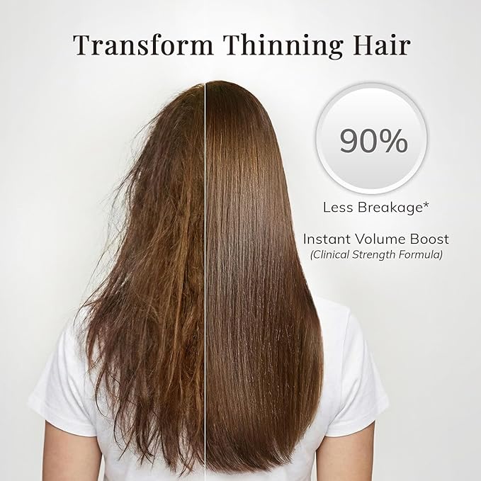 RootStim Thickening Conditioner for Thinning Hair: Anti-Breakage Formula with Rosemary Oil, Saw Palmetto & Hydrolyzed Keratin – Volumizing Treatment for Men & Women – Sulfate & Silicone Free, 10 fl oz