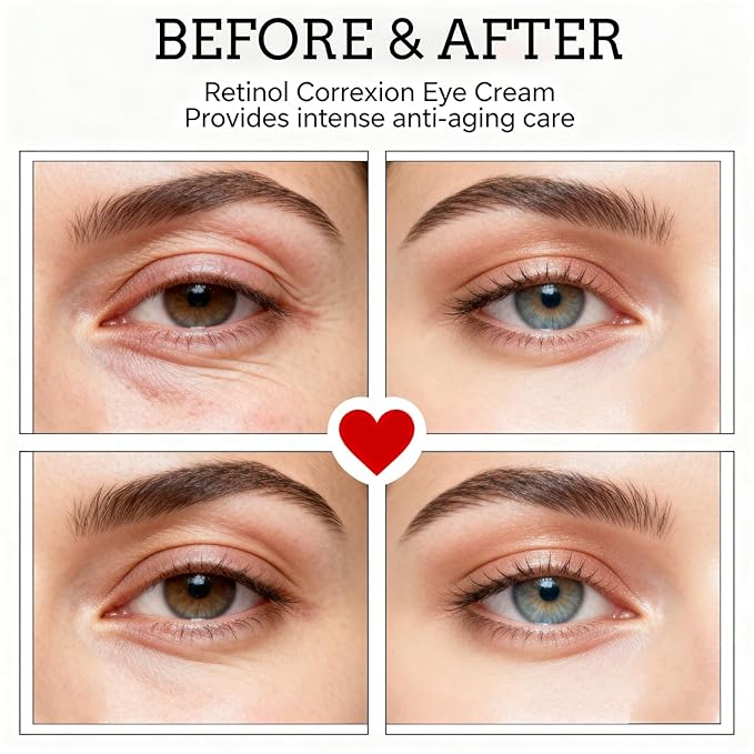 Retinol Eye Cream with Niacinamide, Hyaluronic Acid & Vitamin E – Hydrating Under Eye Cream for Visible Dark Circles, Wrinkle Appearance & Under-Eye Fullness, Anti Aging