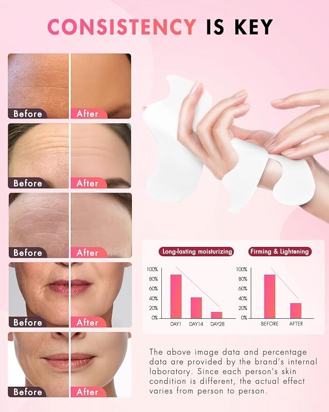 UKVOA Forehead Wrinkle Patches & Smile Line Patches, Overnight Facial Wrinkle Treatment with Hyaluronic Acid, Aloe, Collagen & Vitamin E to Lift Smile Lines for Women 36pcs