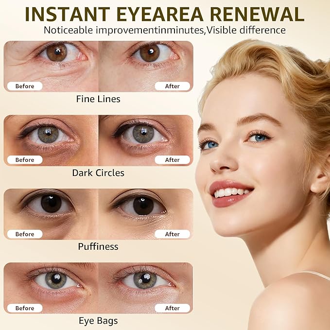 15S Instant Eye Tightener Cream, Firmx Eye & Face Cream Temporary Eye Tightener for Eye Bags, Puffiness & Wrinkles, Dual-Action Firming & Long-Term Repair with 5000ppm PDRN, Panthenol, 0.71 Fl Oz
