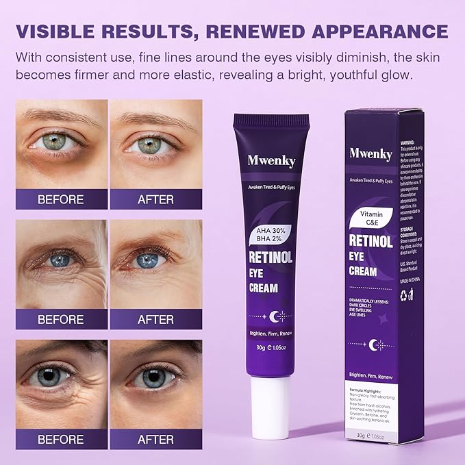 Retinol Eye Cream for Dark Circles and Puffiness, Anti-Aging Under Eye Cream with Hyaluronic Acid, Peptides & Caffeine, Helps Reduce Eye Bags, Smooth Wrinkles and Fine Lines, Hydrating Eye Treatment