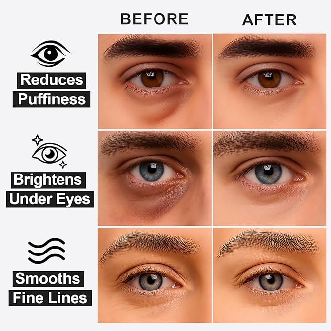 Black Optics Hydrogel Eye Patches 28 Pairs, 15-Min Revitalizing Eye Masks with Caffeine Peptides Black Truffle, Reduce Puffy Eyes Dark Circles & Wrinkles, Luxury Spa Gifts for Men & Women