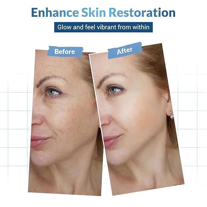 Dermatouch Collagen Eye Cream - Hyaluronic Acid and Caffeine Antioxidant Skin Treatment, Wrinkle Reducer, 1.6 Oz.