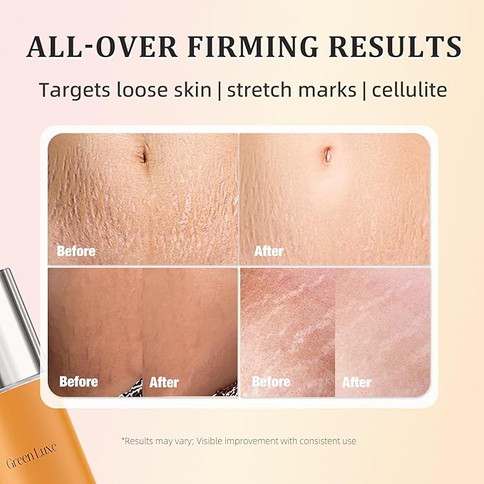 Belly Firming Cream – Become Flat Skin Tightening Cream for Body: Lift & Tone Tummy, Thighs, Booty & Arms – Stretch Mark & Cellulite Sculpting Lotion for Women – 3.38 Fl Oz