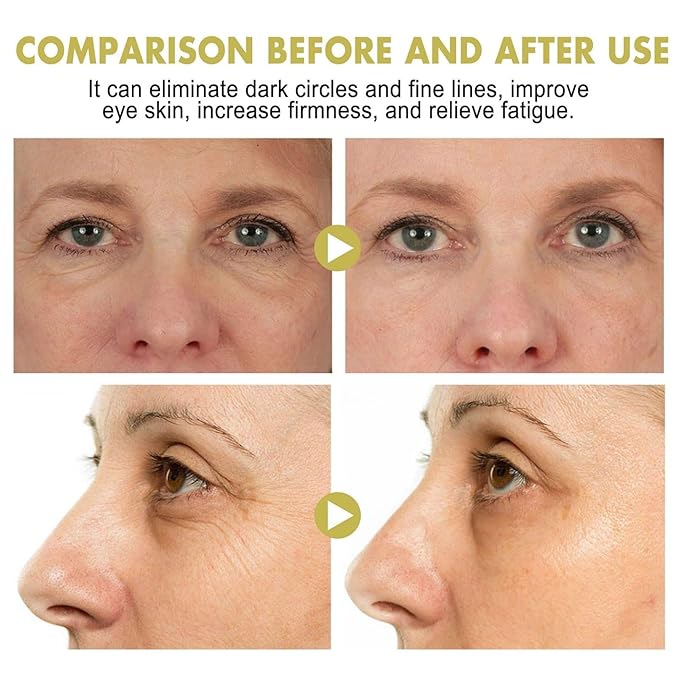 Mineral Oil Eye Stick - Hydrating Treatment To Minimize Puffiness & Fine Lines, Nourish Delicate Eye Area(#2,2pcs)