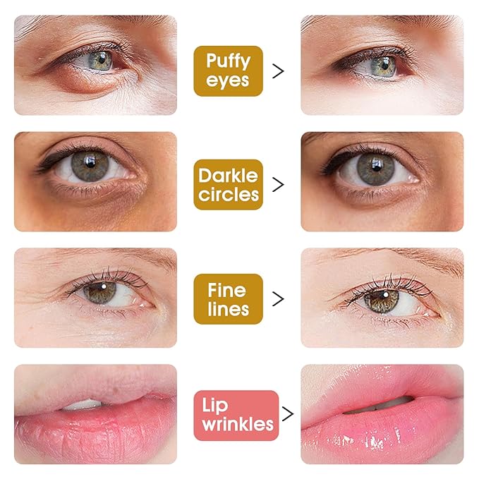 Adofect 40 PCS Under Eye Patches and Pink Lip Mask 24K Gold Eye Mask for Puffy Eyes Collagen Lip Masks and Crystal Eye Mask Reducing Fine Lines for Women and Men