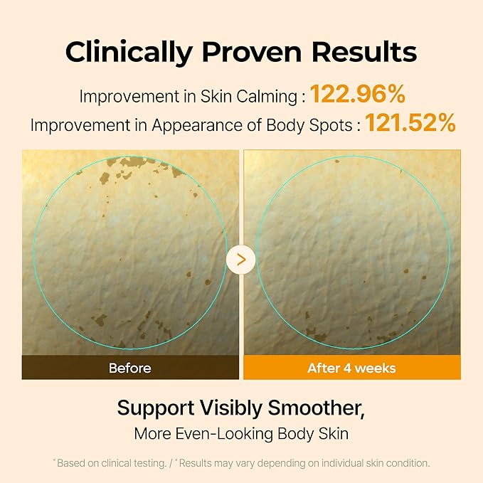 Dr.Melaxin Kojic Acid Turmeric Body Cream with Ceramides, Brightening Body Moisturizer for Dark Spots & Uneven Tone, Panthenol & Hyaluronic Acid for Deep Hydration, 7.05 oz