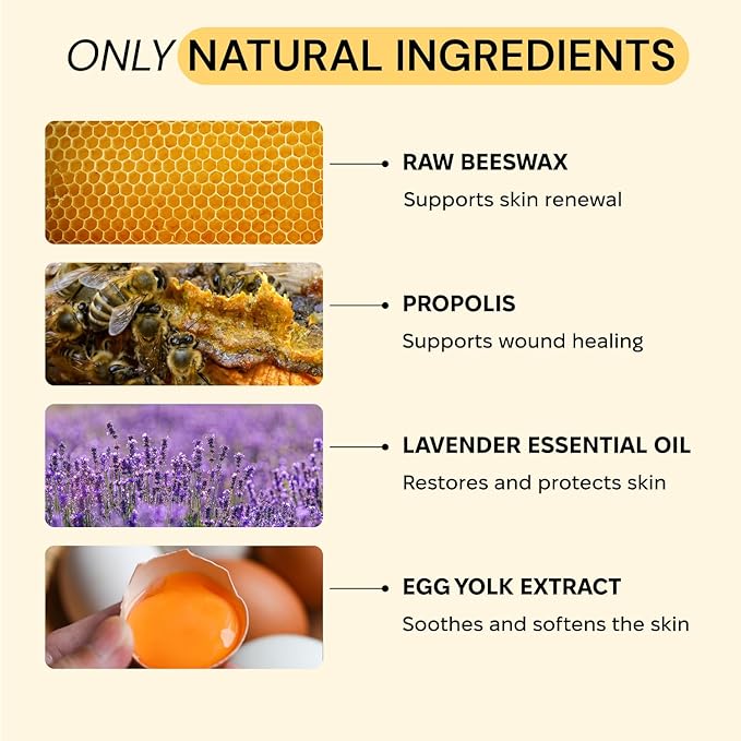 MyMagicHealer Universal Flare Care | Drawing Salve for HS, Boils, Cysts, Hemorrhoids, Pilonidal Cyst, Abscess | Anti-Chafing, Wound Care, Relief for Itching Skin w/Propolis & Egg Yolk Extract 1 oz