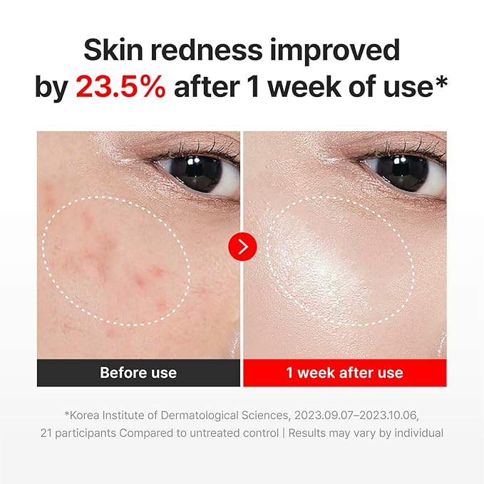CENTELLIAN 24 Madeca Cream Time Reverse Full Moon Edition (1.69 fl oz+0.5 fl oz / 50ml+15ml) – Advanced Anti-Aging Moisturizer with Centella Asiatica, Collagen, Firming & Hydrating Korean Skincare