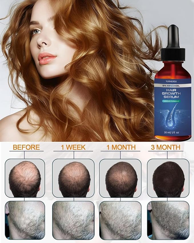 Hair Growth Serum, 5% Minoxidil, With Biotin & Glycerin, for Men's Beard & Women's Hair Regrowth, Anti Hair Loss Treatment, Make Hair Stronger Thicker Longer, 1 fl oz (30 ml)