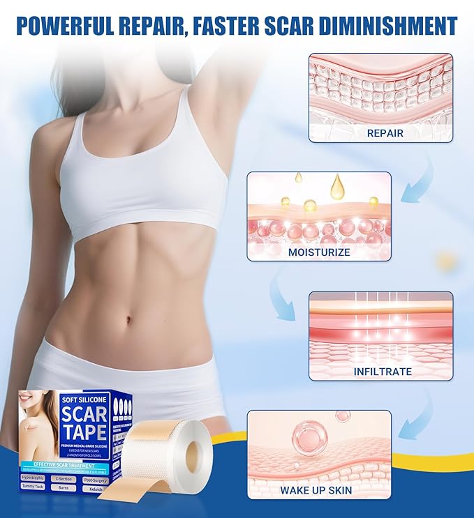 MasterMo Medical Grade Silicone Scar Sheets & Tape - Ultra Soft, Hypoallergenic Rolls (1.6”x120" Roll) for Surgical, C-Section, Tummy Tuck, Keloid Scars, Stretch Marks & Burn Scar Removal