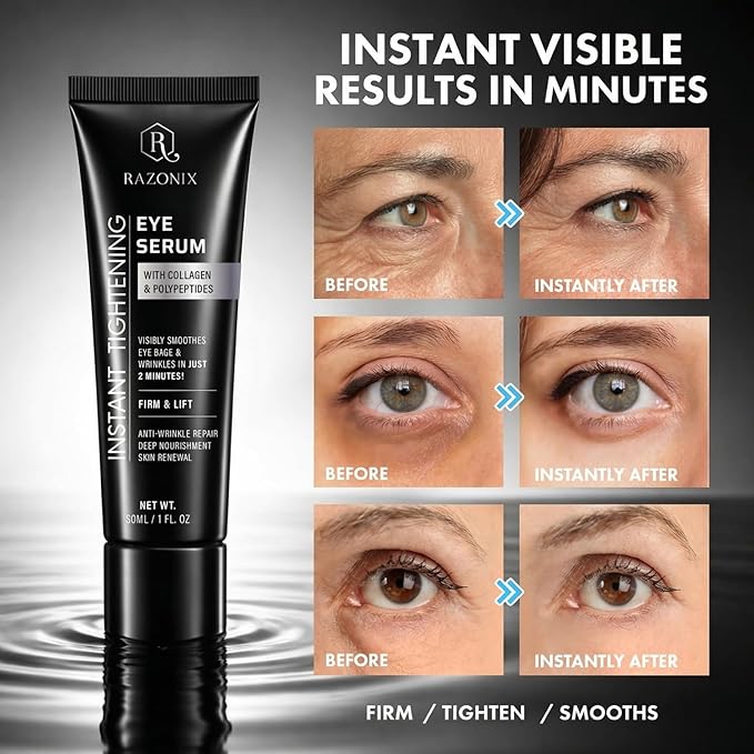 RAZONIX Instant Eye Tightening and Lifting Serum, with Hyaluronic Acid and Caffeine, for Under Eye Bags, Puffiness, Dark Circles, and Wrinkles, Serum Form, 0.5 fl oz (Medium, Unscented)