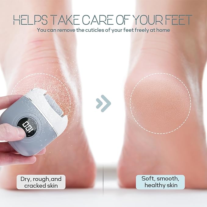 KAZLIE Electric Foot Callus Remover, Rechargeable & Waterproof Pedicure Tool with 3 Roller Heads, 2 Speeds for Dead, Hard, Cracked, Dry Skin Care