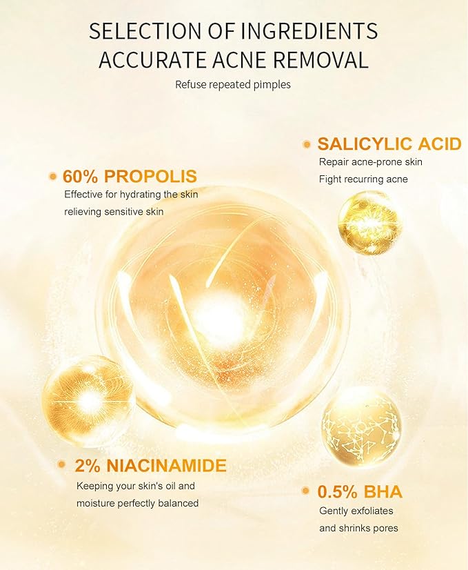 Propolis and Niacinamide Hydrating Facial Soothing Moisturizer, Glow Boosting Serum for Face for Acne-prone&Sensitive skin, Minimize breakouts, Korean skincare 30ml, 1 fl.oz