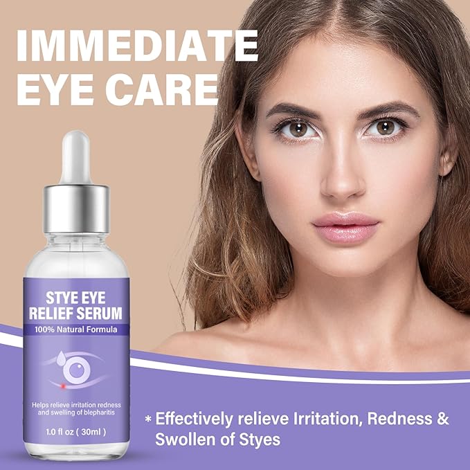Stye Eye Treatment, Natural Stye Eye Drops for Chalazion and Blepharitis Relief, Gentle Daily Eye Care, Soothes Irritation Redness and Swelling, 1 Fl Oz / 30 Ml