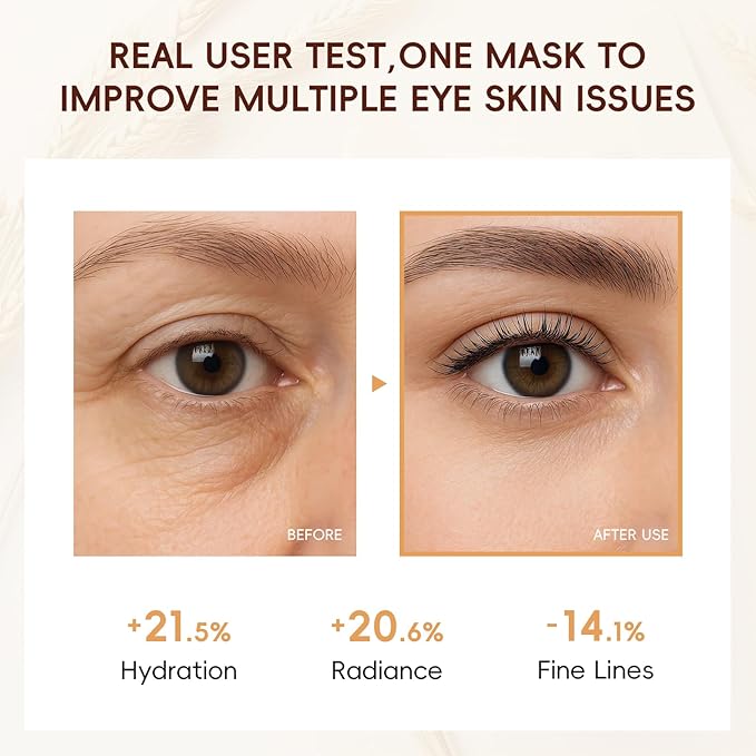 AKARY 94.4% Triple Rice Ferment Complex Under Eye Pathes 10PCS, Moisturizing, Firming, Glowing, Deeply Nourishing & Radiant Eyes Skin Gel Eye Masks for Dark Circles, Wrinkles, Eye Bags & Puffy Eyes