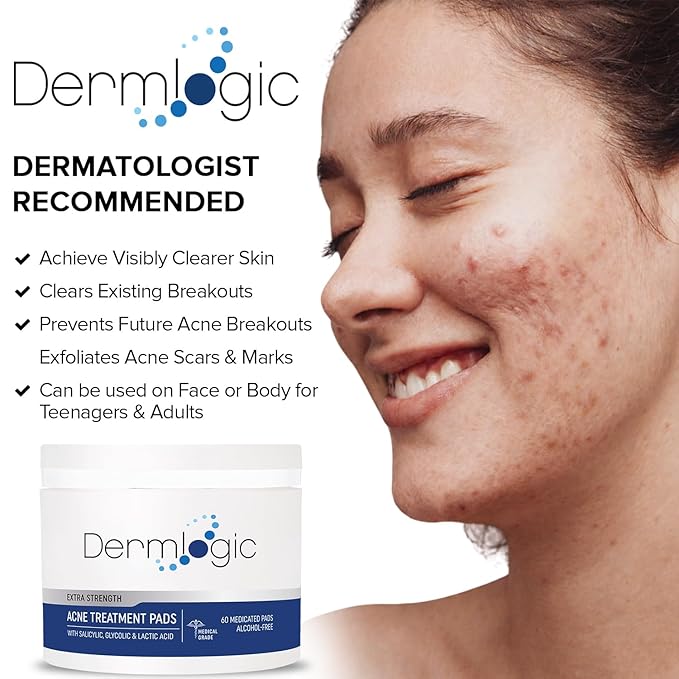 Acne Treatment Pads- Contains Salicylic, Glycolic, & Lactic Acid for Face & Body. Clears Away Clogged Pores, Oily Skin & Cystic Breakouts. Removes Dark Spots, Blackhead & Whitehead Pimples