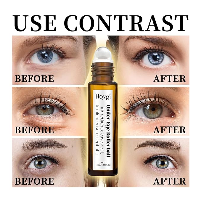 Castor Oil and Frankincense Eye Roller for Dark Circles, Puffy Eyes, and Wrinkles, Anti Aging Eye Serum Cream, 0.34 Fl Oz
