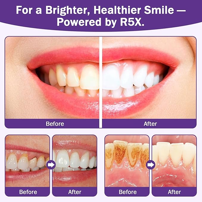 Teeth Whitening Powder, 2PCS Purple Toothpaste Whitening Powder | Teeth Whitening & Removes Stains & Breath Freshener | Hydroxyapatite, R5X Remineralizing for Coffee, Tea, Food, Wine, Tobacco Stains