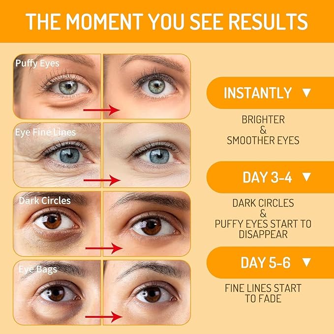 Eye Patches for Dark Circles and Puffiness with Retinol, Collagen, Vitamin C, Hyaluronic Acid - 60pcs Anti Aging Under Eye Masks for Undereye Brightening, Hydrating, Anti-Wrinkle & Cooling (Golden)