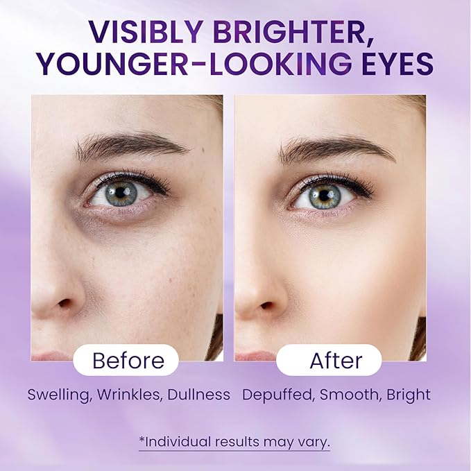 Caffeine & Retinol Eye Serum –Under Eye Serum for Dark Circles and Puffiness, Corrects Puffy Bags, Fine Lines & Wrinkles, 8Hr Hydrating Under Eyes Cream – 0.7 fl.oz