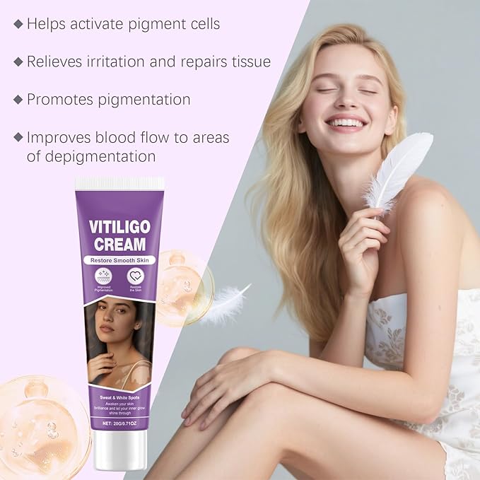 Vitiligo Cream, Vitiligo Treatment Cream， Reduce White Spots，Easy to Use