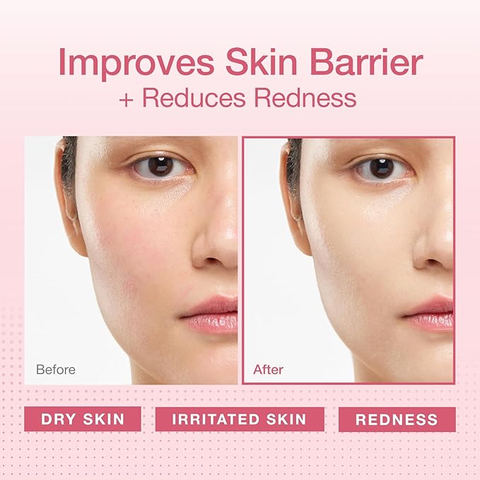 Physiogel Redness Reducing Cream – Ceramide Moisturizer for Dry, Sensitive & Redness-Prone Skin, Repairs Skin Barrier, Dermatologist-Tested, Fragrance-Free, Korean Skincare, 3.4 fl oz (Pack of 2)