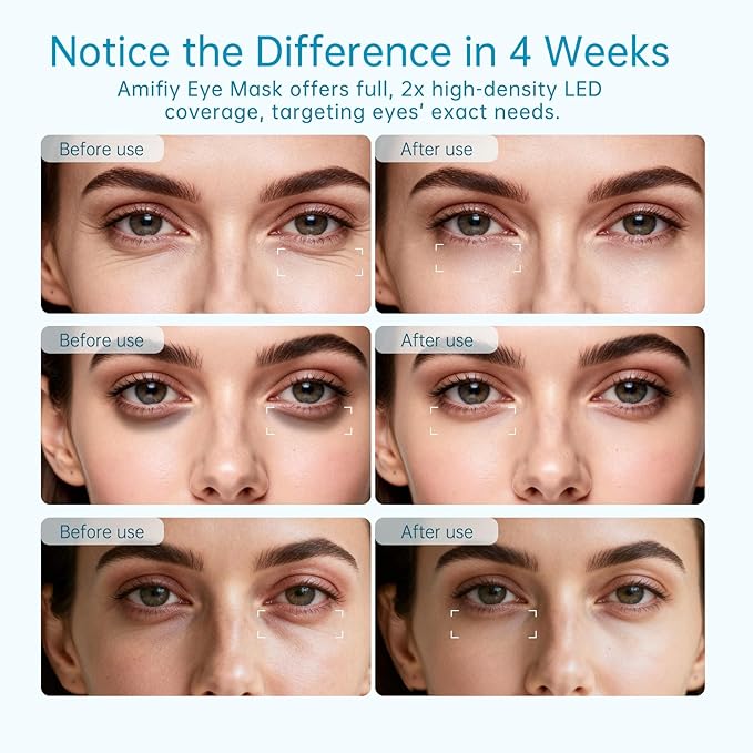 Red Light Therapy for Eyes, Infrared LED Eye Mask for Under Eye Dark Circles, Puffiness & Wrinkles, Anti-Aging Collagen Booster in Just 3 Minutes a Day, Soft Silicone