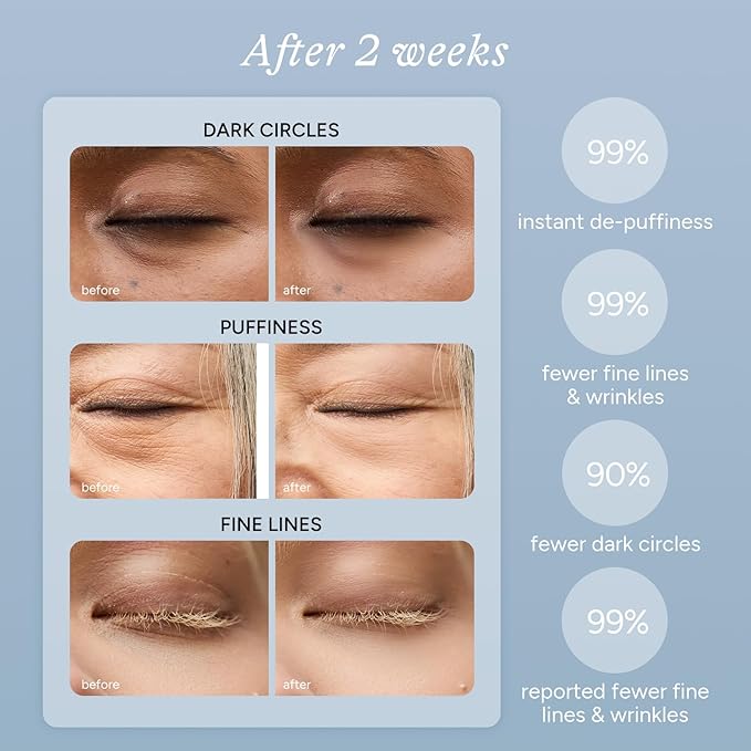 Caffeine & Hyaluronic Acid Under Eye Patches - 5 Pairs, 360° Coverage Targets Dark Circles, Puffy Eyes, Fine Lines & Eye Bags Hydrating Restoring Gel Eye Masks (PRO)