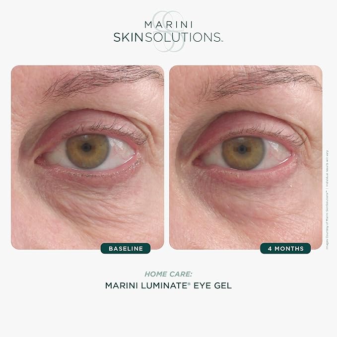Marini SkinSolutions Luminate Eye Gel - Reduces Appearance of Dark Circles, Crepey Skin, Fine Lines & Wrinkles with Retinol, Chromabright & Peptides - Cruelty Free - Made in the USA - 0.5 fl oz