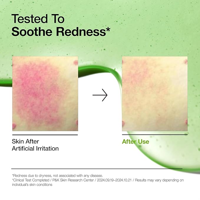 Anua Soothing & Barrier Support Duo, Azelaic acid serum for face with Ceramide barrier moisturizer, Spot Care & Calming Effect, Korean Skincare Set