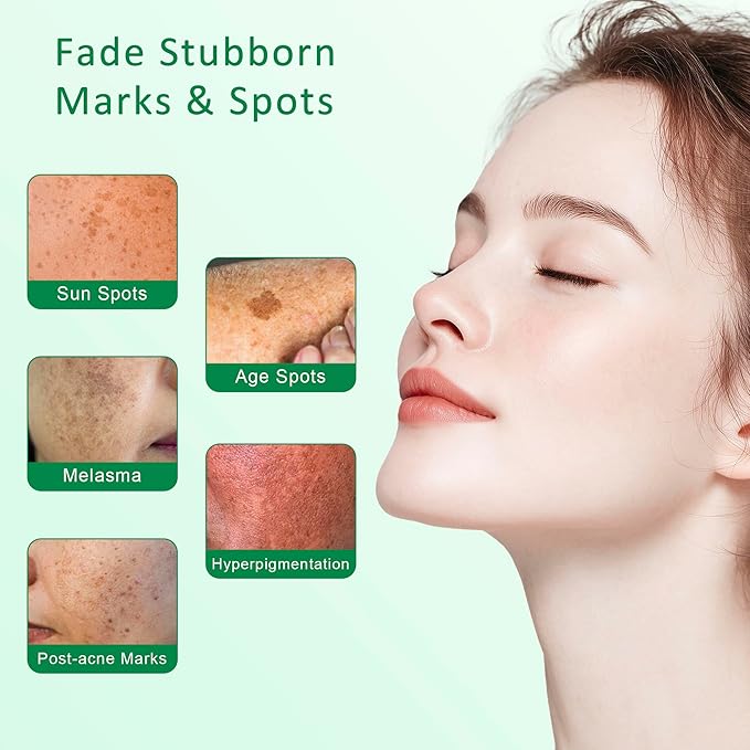 Dark Spot Remover for Face & Body – Dark Spot Corrector Serum for Hyperpigmentation, Brown Spots & Melasma Treatment - 1.7 fl oz