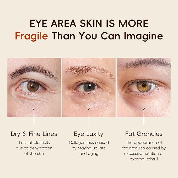 AKARY Vitamin C Eye Cream & Under Eye Serum, Refreshing, Hydrating, Radiant Glow Skin Roller Serum with 360° Massage Ball, Tightening for Women Reduce Wrinkles Fine Lines