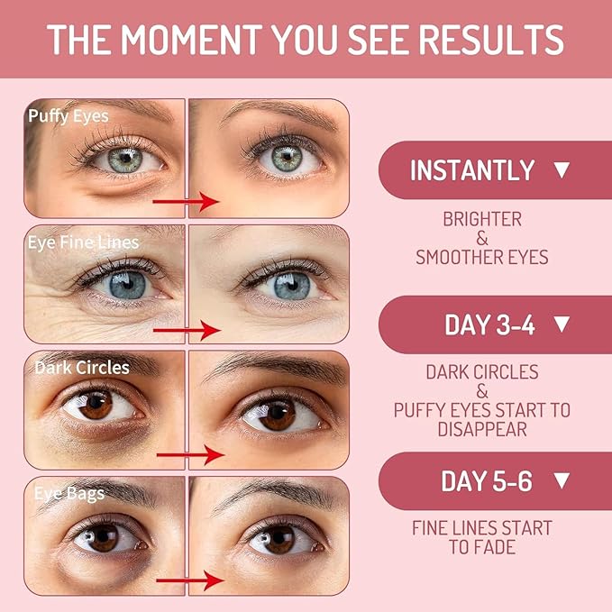 AOAO Revitalizing Niacinamide & Vitamin C Eye Masks, Brightening & Anti-Dark Circles, with Alpha-Arbutin & Hyaluronic Acid, Dark Circle Corrector, Pink Hydrating Under Eye Patches, 60 Pcs