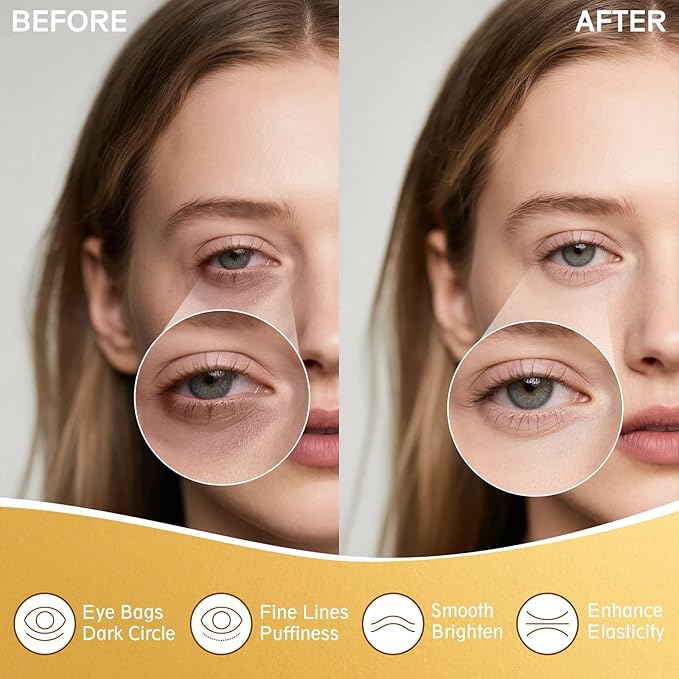 Under Eye Patches for Puffy Eyes and Dark Circles (20 Pairs) Collagen Eye Patches with Hyaluronic Acid & Niacinamide, Eye Mask for Moisturizing, Fine Lines, Dark Circles Under Eye Treatment