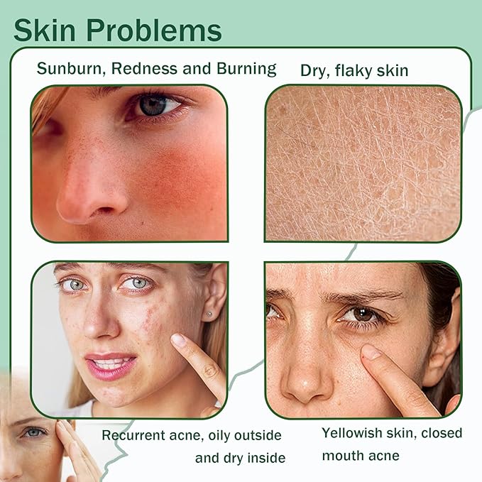 Moisturizing Gel for Face & Body,Non-sticky Gel After Sun Aloe Lotion Skin Care,Fast Absorbing Long Lasting Refreshing Hydrating Face Moisturizer for All Skin Types I