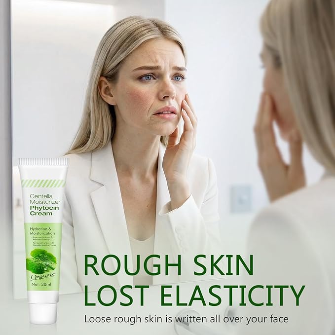 ITECFREELY Moisturizer Phytocin Cream, Natural Centellâ Asiatica Extract Cream for Sensitive Skin, Helps Soothe and Hydrate for Smoother Skin