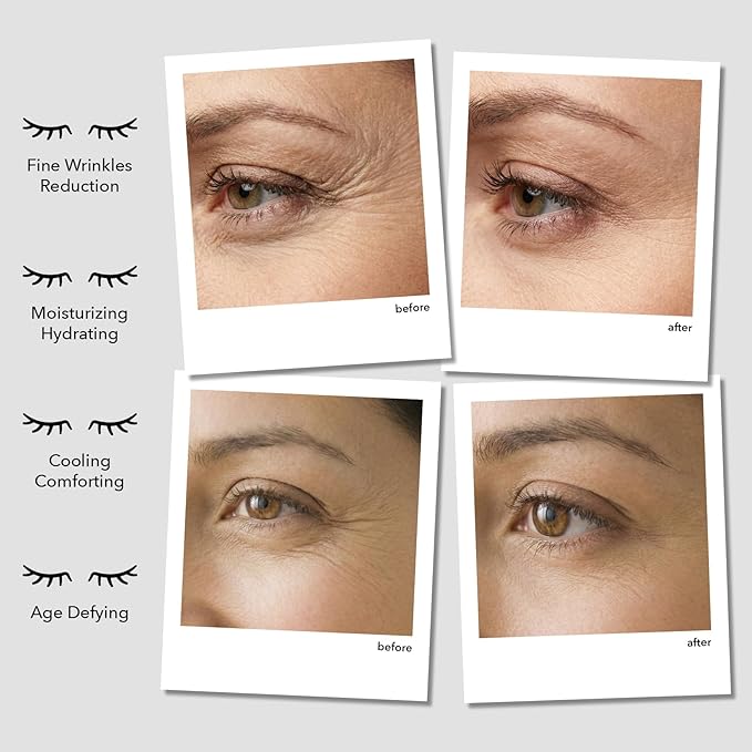 Anti-Wrinkle Under Eye Patches – Hydrating Eye Mask with Japanese Hydrophilic Gel Technology to Reduce Fine Lines, Moisturize, Cool, and Soothe – Suitable for All Skin Types (5 Pairs)