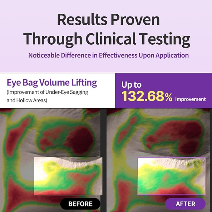 Retinol Volume Eyebag Cream - Reduce Puffy Eyes, Undereye Bags, Firming with Retinol, Korean Skincare Hydrating, Lifting Cream 10ml / 0.33 Fl Oz