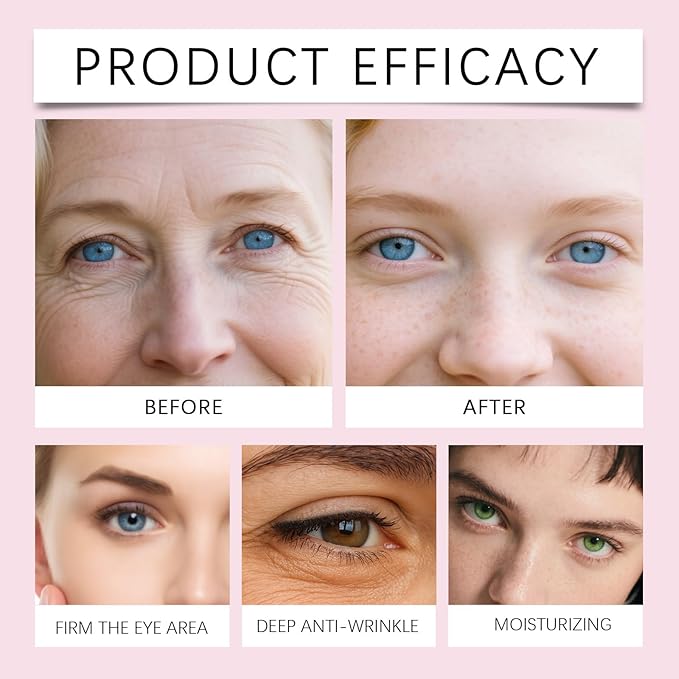 Collagen Eye Patches, Peptide Eye Patches - 30 Pairs Collagen Under Eye Patches | 15-Min Hydrating Hydrogel Eye Mask for Firming, Brightening, Pregnancy Safe (Men & Women)
