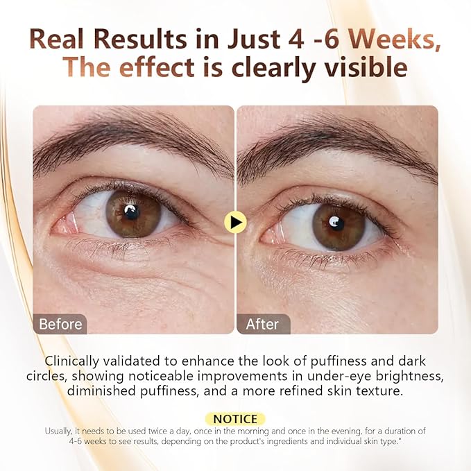 COSMOO Snail Peptide Under Eye Cream, Eye Cream for Dark Circles and Puffiness, Eye Bags, Wrinkles Fine Lines Skin Care Treatment Firming With Snail Mucin and Niacinamide, Korean Skin Care Formula