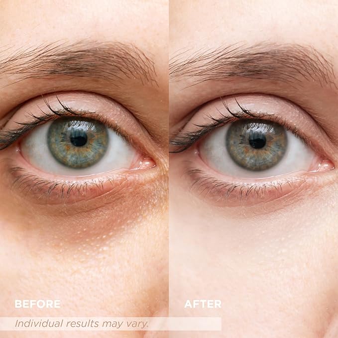 VELAMO ADVANCED Luminous Eye Corrector SPF 41(Shade: Medium) & Upgraded Retinol Under Eye Balm with Collagen Duo: for Dark Circles, Fine Lines & Puffiness - Hydrating Anti Aging Under Eye Cream