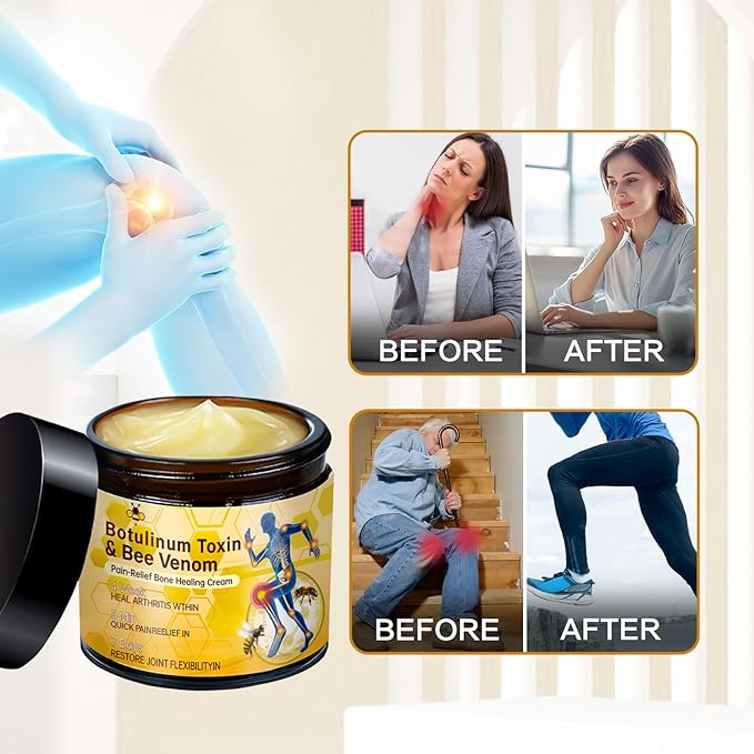2Pcs Bee Venom Joint Gel Cream, Bee Venom Advanced Joint and Bone Cream, Advanced Professional New Bee Venom Professional Gel, for Back, Neck, Hands, Knee