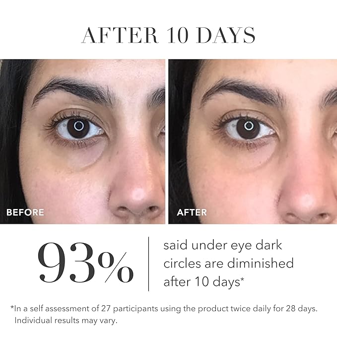 Algenist Triple Algae Eye Renewal Balm - Firming + Smoothing Cream with Alguronic Acid to Help Reduce the Appearance of Dark Circles, Bags, Puffiness, Fine Lines + Wrinkles (0.5 oz)