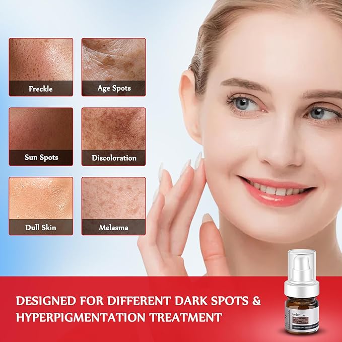 Dark Spot Remover for Face and Body - Dark Spot Corrector Serum for Acne Scars, Melasma, Age, Sun, Black Spots | Advanced Formula for Women and Men |Suitable for Oily, Dry and Combination Skin, 1.35FL