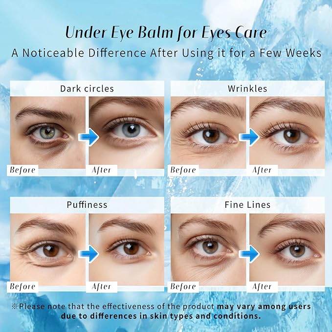 dewyhour Under Eye Balm Stick for Dark Circles and Puffiness - Cooling Moisturizing Eye Cream for Wrinkles & Under Eye Bags | Under Eye Treatment | Korean Skin Care