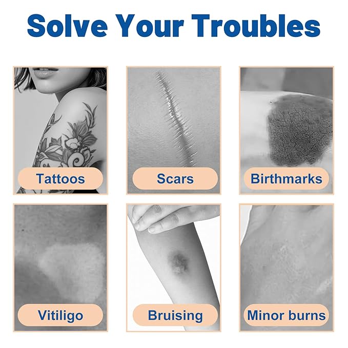 10 Pack Tattoo Cover Up Patchs,Invisible Waterproof Cover-up Skin Stickers for Tattoos Scars Bruises Birthmarks Concealer,0.02mm Ultra Thin Natural Looking,Flexible & Cuttable