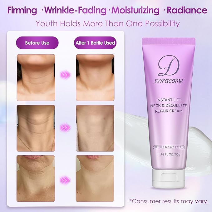 Retinol Neck Firming Cream – Neck Cream for Firming and Tightening, Skin Tightening Cream for Face, Tighten and Lift Neck Cream with Collagen & Hyaluronic Acid, Anti-Aging Moisturizer - 1.76 fl.oz