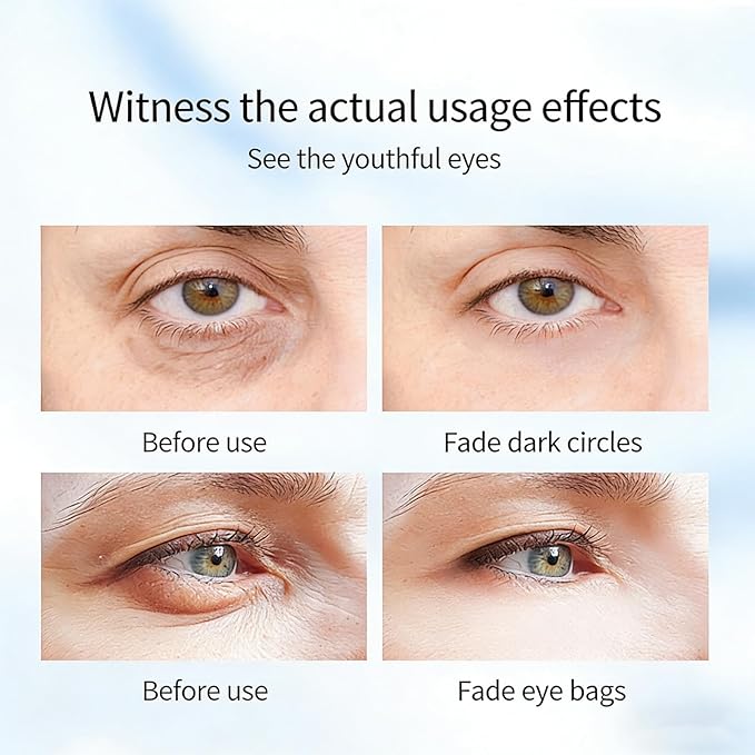 Rapid Reduction Eye Serum for Under-Eye Bags & Wrinkles - Visibly Minimizes Puffiness & Fine Lines, Anti-Aging Serum for Face with Temporary Lifting Effect, Full Size Formula (1)